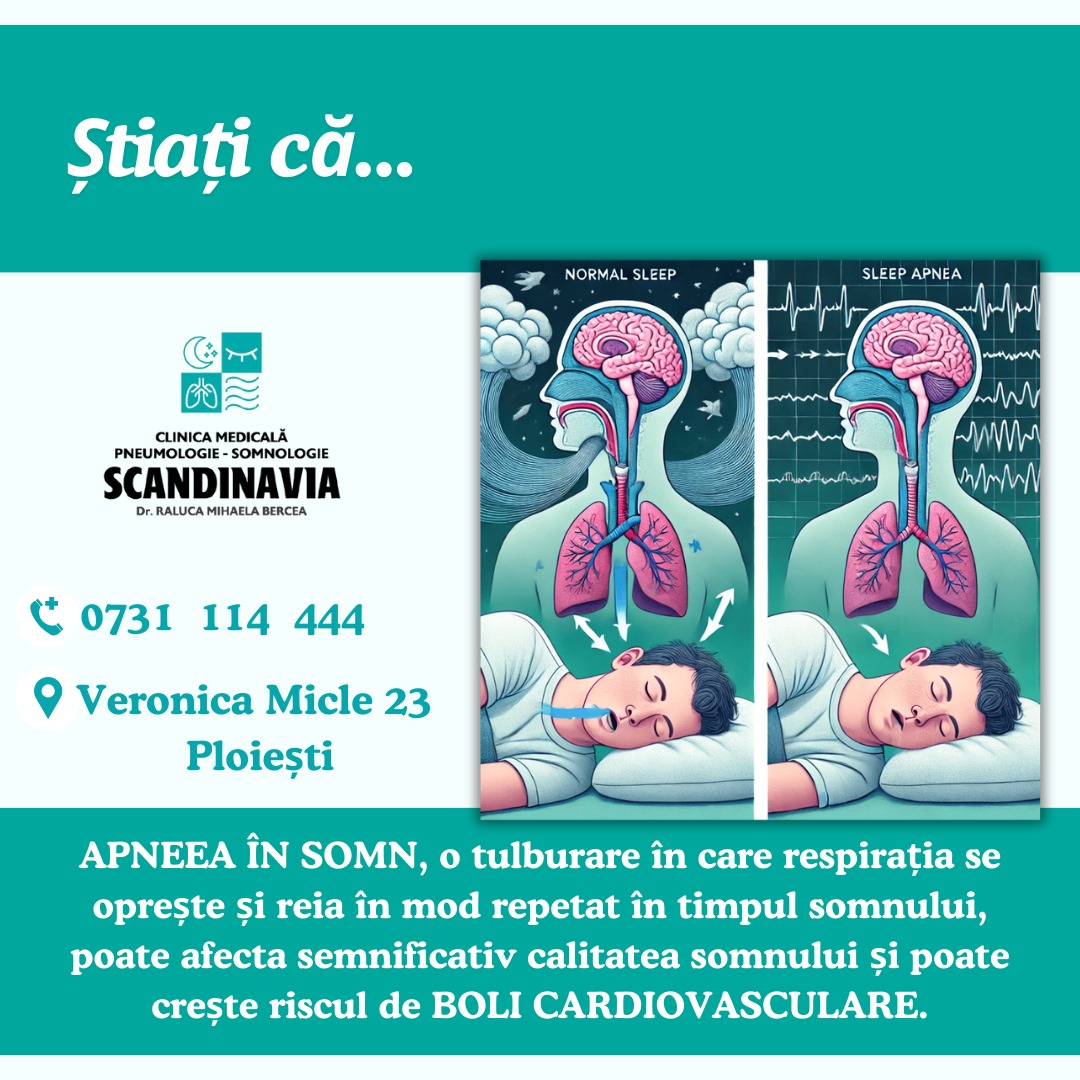 Apneea în somn